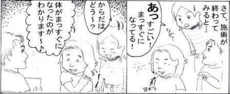施術後の真直ぐ