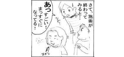 施術後の真直ぐ1